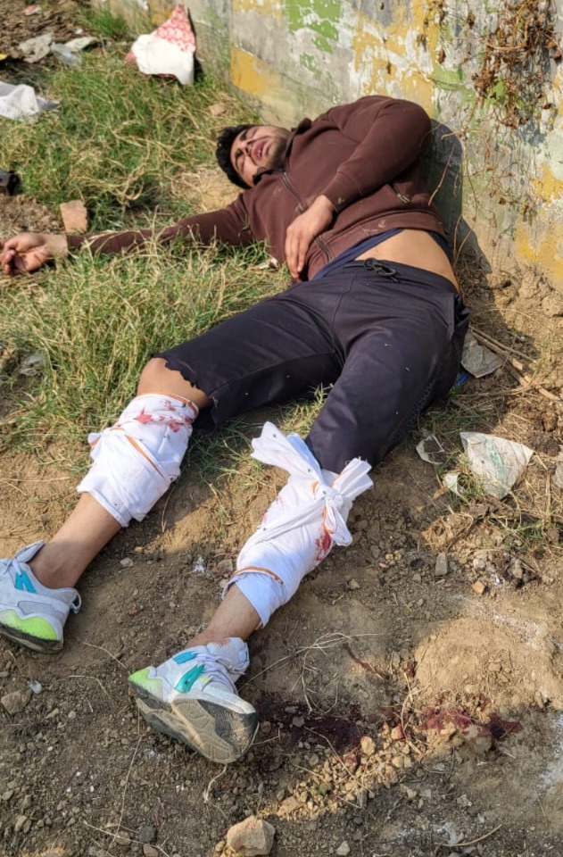 शाहजहानपूरमध्ये खत समितीच्या सचिवाला लुटणाऱ्या गुन्हेगाराशी चकमक