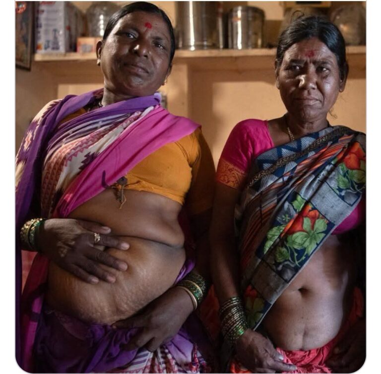 ऊसतोड मजुर महिलांचे “काम थांबू नये म्हणून गर्भाशय काढा” — बीडमधील महिलांवरील अमानवी दबावाचा जागतिक स्तरावर पर्दाफाश ?